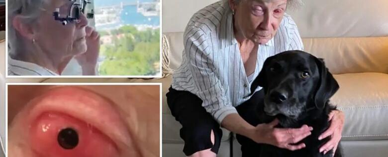 بعد عشر سنوات.. امرأة تستعيد بصرها عبر زرع سنّها في عينها