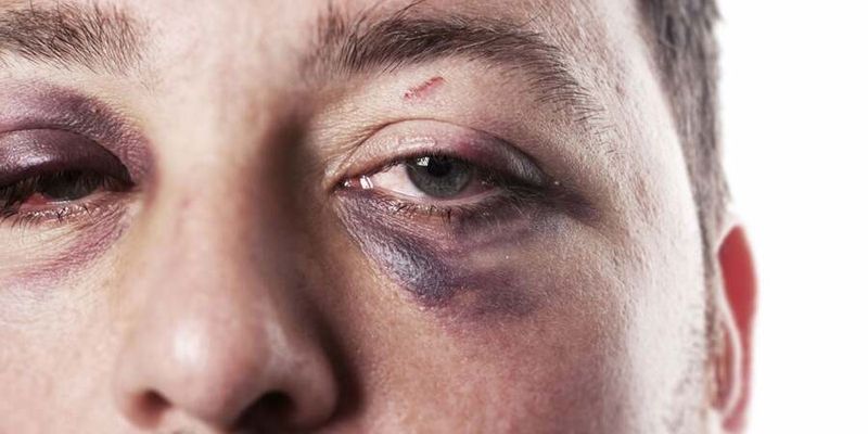 حصل في كوردستان..الرجال يشكون من عنف النساء ويقدمون إحصائيّات ب"ضحاياهم"!