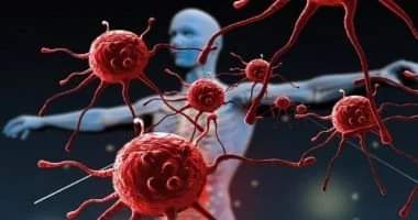 تقرير: مع حلول العام 2050 السرطان سيتفشى كموجة عارمة 