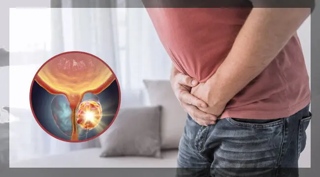 للرجال فقط.. توقعات بارتفاع معدلات الإصابة بهذا النوع من السرطان