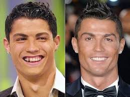 رونالدو بين الأمس واليوم.. جرّاح يكشف أسرار تغيّر ملامح رونالدو
