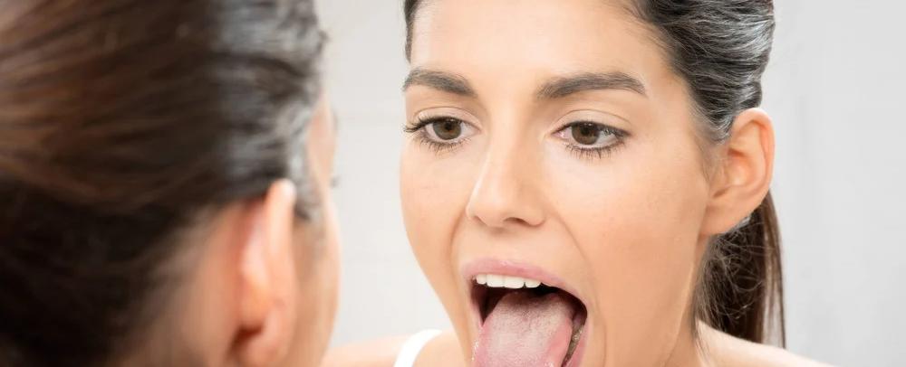 متلازمة جفاف الفم: ما أسبابها وكيف يمكن علاجها في المنزل؟