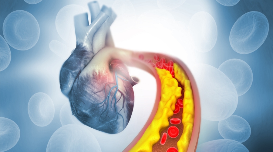 أطعمة تنظّف الشرايين وتحسّن الدورة الدموية.. ما هي؟ 