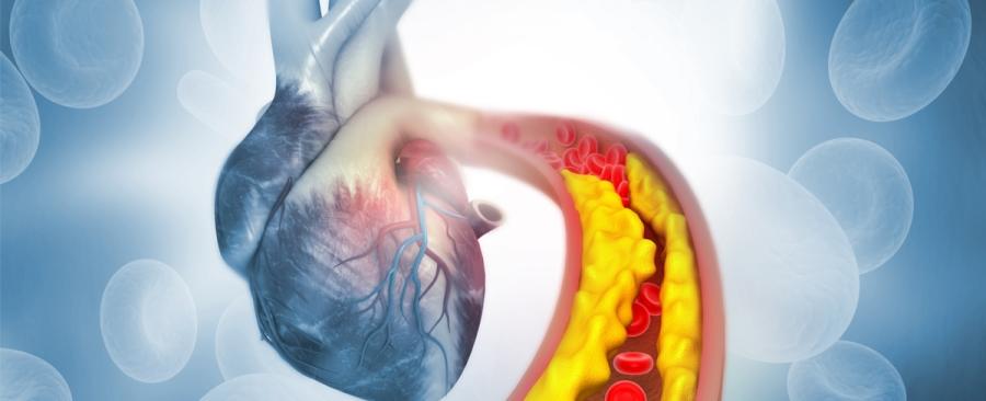 أطعمة تنظّف الشرايين وتحسّن الدورة الدموية.. ما هي؟