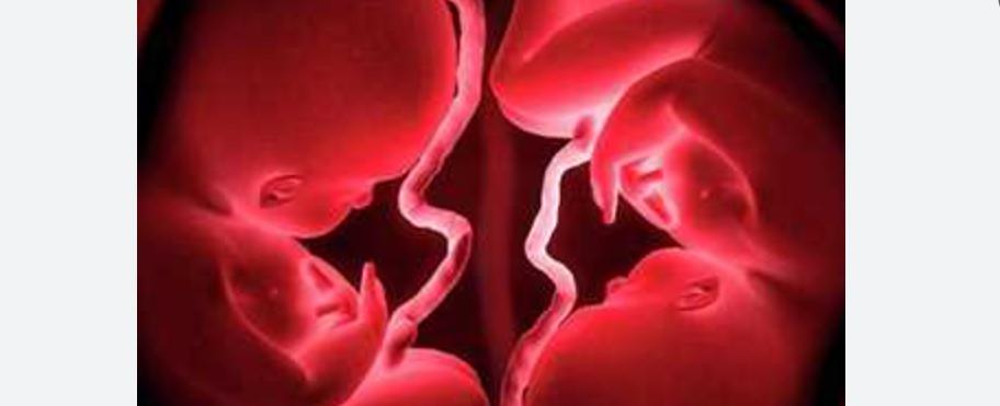 واحد من كل رحم.. في حالة نادرة امرأة بـ"رحمين" تنجب توأمًا