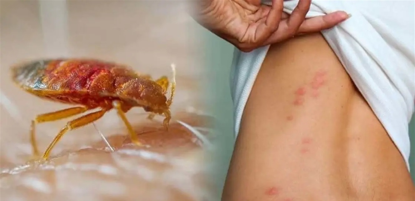 عدو يشاركك فراشك ويمتص دمك.. ما هو بقّ الفراش؟