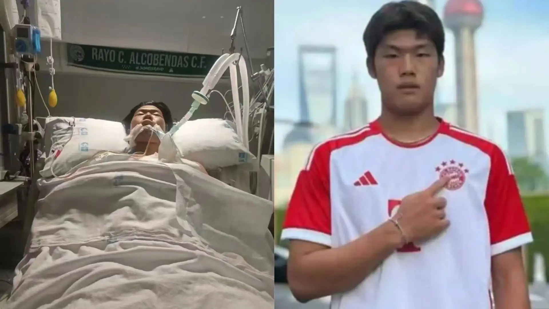 خلال مباراة كرة قدم.. ضربة تدخل لاعبا في "موت دماغي"