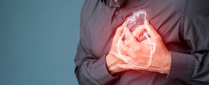 دراسة تنسف معتقدًا شائعًا: "النوبة القلبية ليست فجائية"