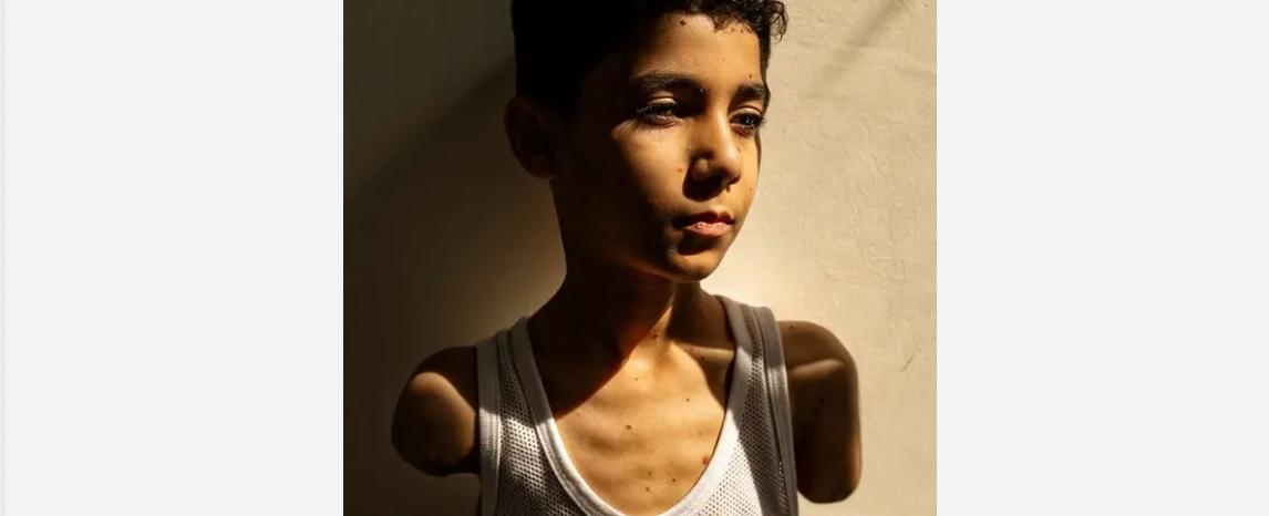 من بين ٦٠ ألفًا.. "صورة العام" لطفل فلسطيني تحصد الجائزة الأولى