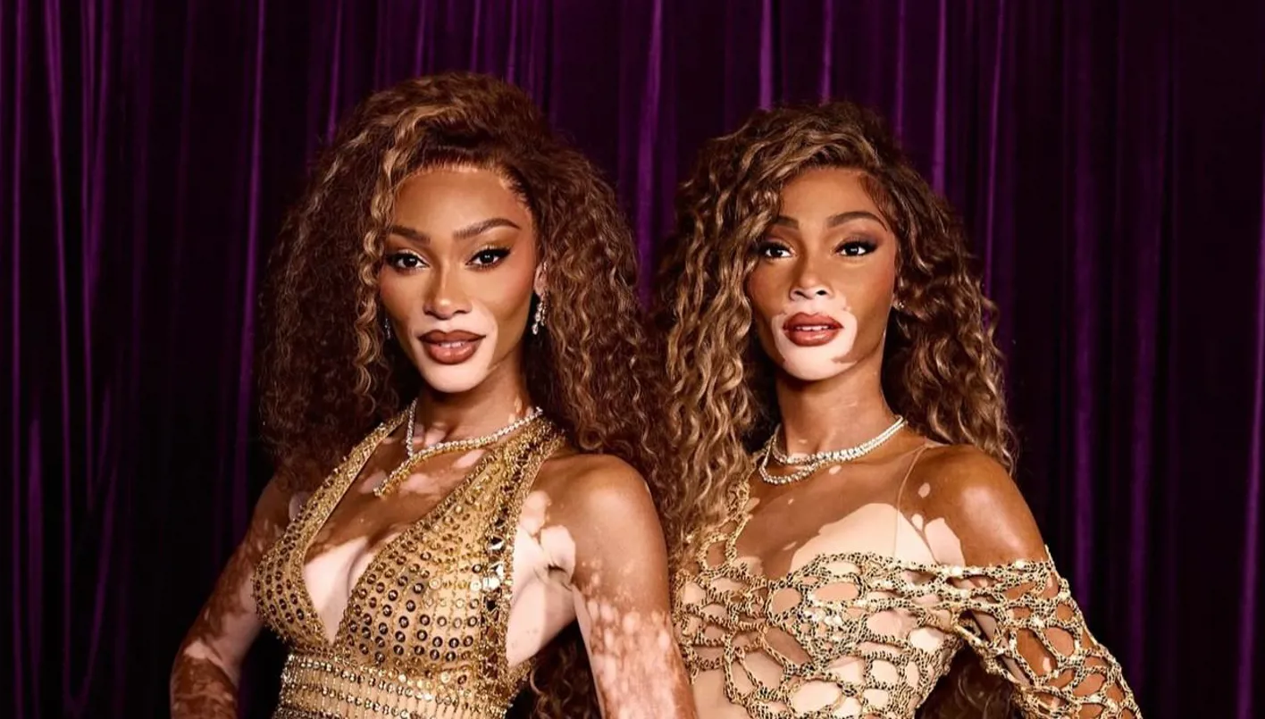 في اليوم العالمي للبهاق.. ويني هارلو بتصميم زهير مراد في متحف مدام توسو  