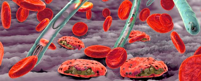 مرض الفراعنة الفتّاك.. بعد صراع لقرون مصر تنتصر عليه