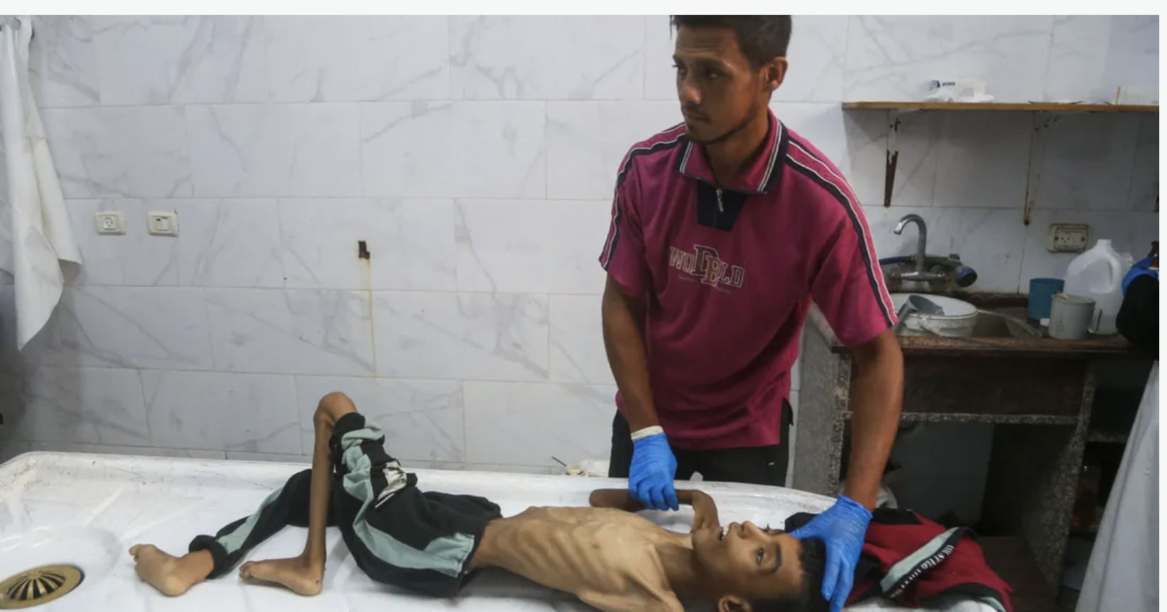 يصيب العشرات في غزة... ما هو "الشلل الرخو الحاد"؟