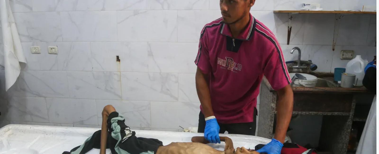 يصيب العشرات في غزة... ما هو "الشلل الرخو الحاد"؟