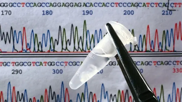 في اليوم العالمي للتوحّد.. لغز جيني وراء إصابة البعض