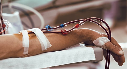 دراسة يابانية تكشف فعالية عقارٍ للإمساك في علاج مرض الكلى المزمن