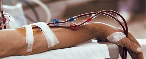 دراسة يابانية تكشف فعالية عقارٍ للإمساك في علاج مرض الكلى المزمن