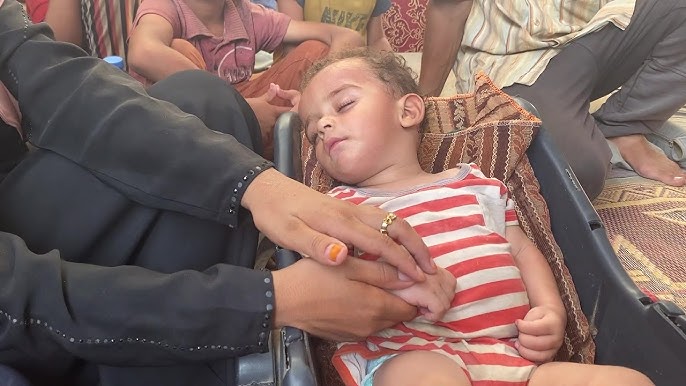 أول مصاب بشلل الأطفال في غزة.. من هو؟