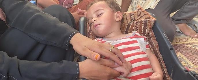 أول مصاب بشلل الأطفال في غزة.. من هو؟