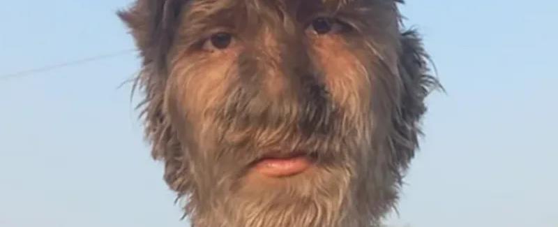 بسبب حالة طبية نادرة.. "مستذئب الهند" يحصد غينيس