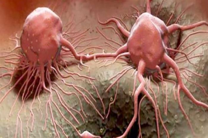 دراسة جديدة تحذر من ارتفاع الإصابة بالسرطان تحت سن الخمسين 