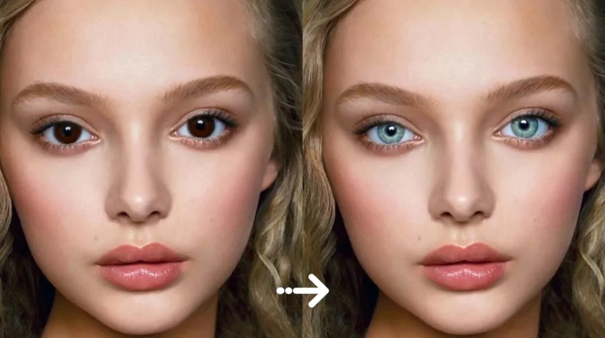 تغيير لون العيون.. عملية تجميل قد تُفقدك بصرك