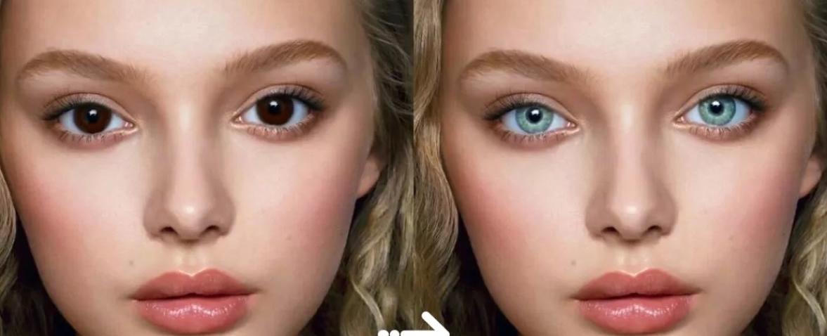 تغيير لون العيون.. عملية تجميل قد تُفقدك بصرك