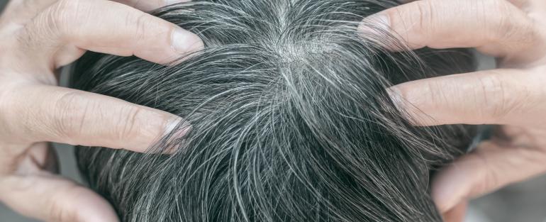الشيب يغزو مفرقك؟... طريقة بسيطة قد تخلّصك من الشعر الأبيض