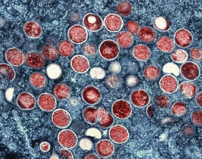 رصد جردي القردة: حالات تظهر في الخليج وأوروبا و"استنفار" عالمي للمواجهة