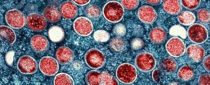 رصد جردي القردة: حالات تظهر في الخليج وأوروبا و"استنفار" عالمي للمواجهة