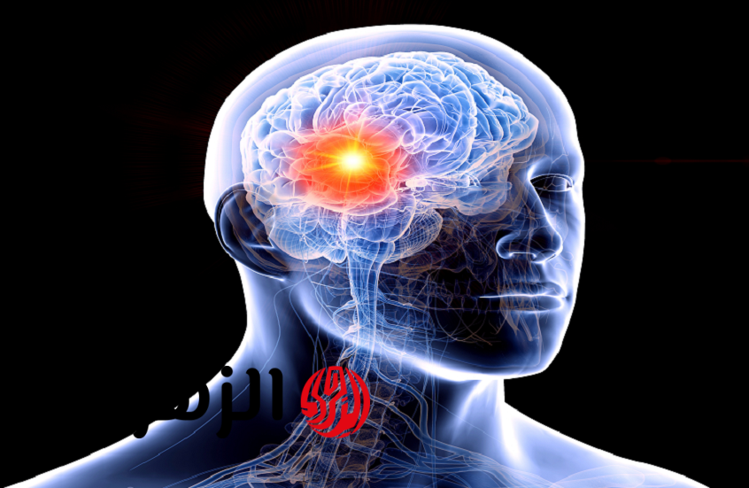 أمل جديد لسرطان الدماغ ـ علاج ثلاثي يزيد فرص النجاة