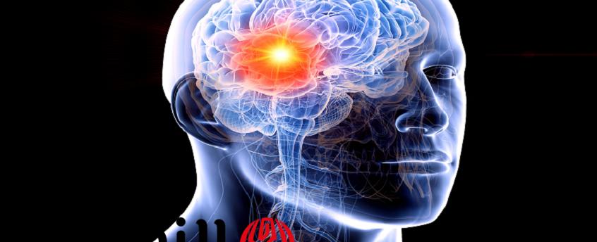 أمل جديد لسرطان الدماغ ـ علاج ثلاثي يزيد فرص النجاة
