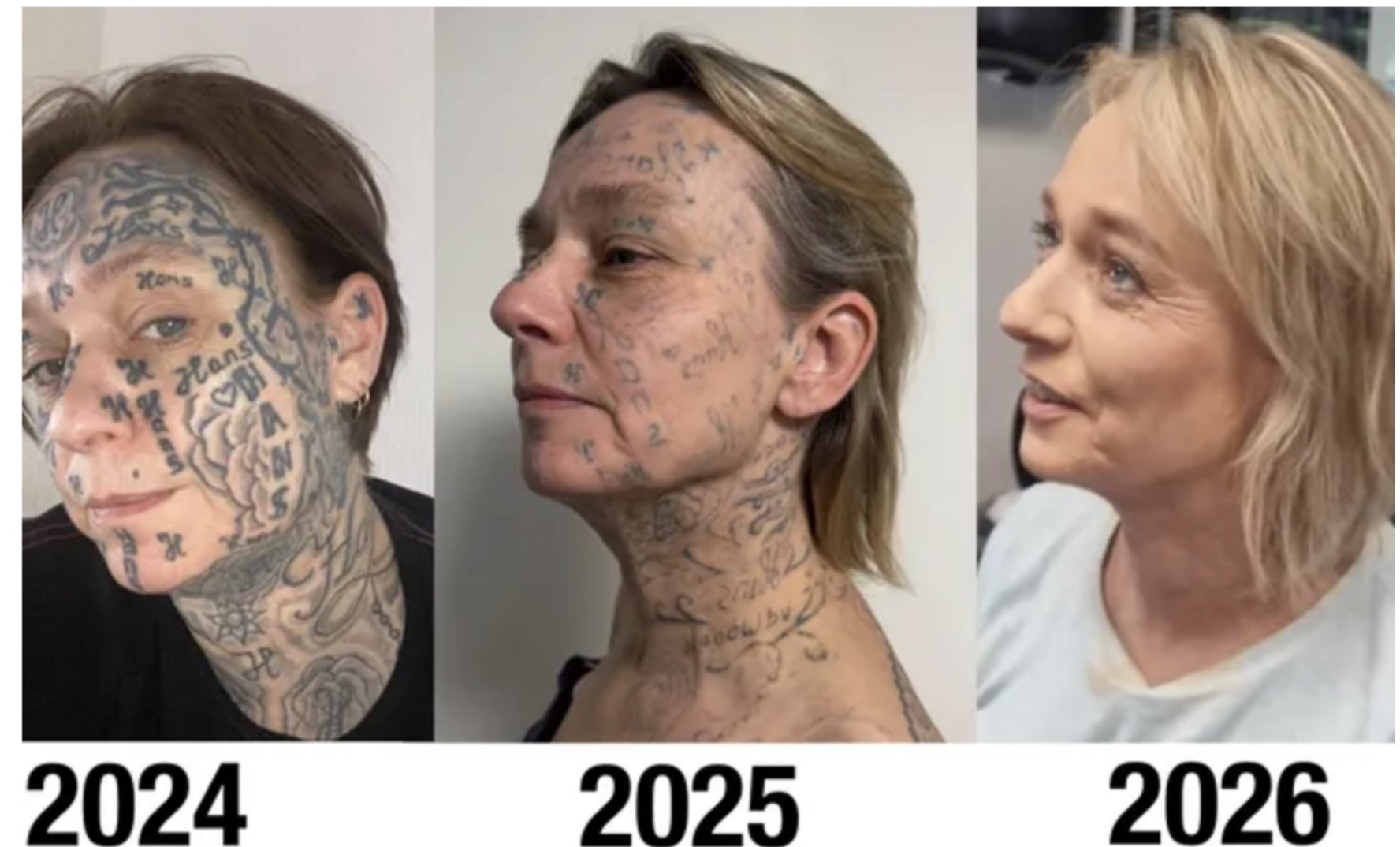 أراد امتلاكها.. رجل يجبر شريكته على وشم اسمه 250 مرة على وجهها وجسدها