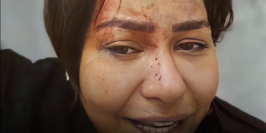 آخر فصول مسلسل شيرين عبد الوهاب وحسام حبيب: هي غارقة بدمها وهو ينقذ ابنتها من "براثنها"