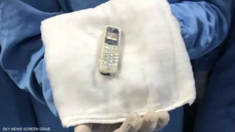 ابتلعه قبل سنوات.. استخراج هاتف من معدة سجين