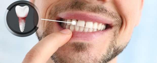 علاج ثوري لابتسامة جميلة.. نمو الأسنان ممكن... بدواء