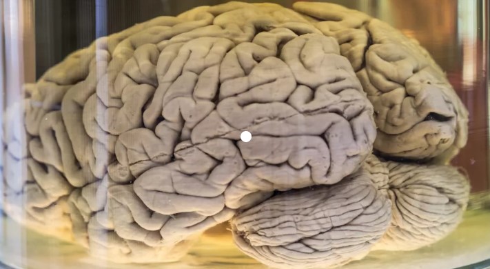 كيف يمكن أن نكافح شيخوخة الدماغ؟