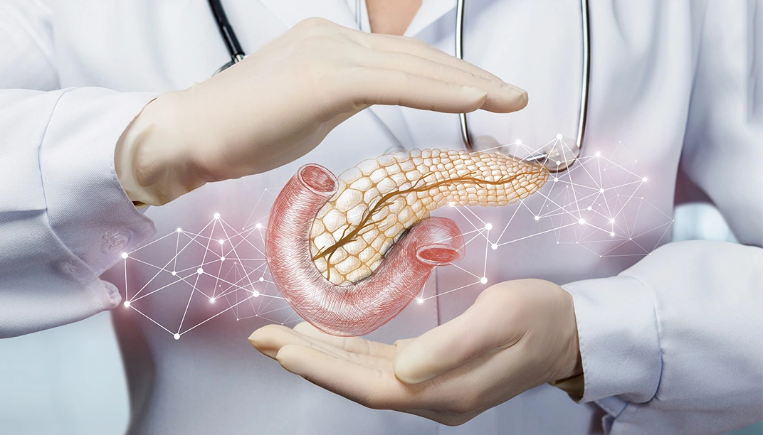 مستويات الأنسولين المرتفعة قد تكون سببا لسرطان البنكرياس