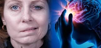 ست علامات تحذيرية للإصابة بالسكتة الدماغية.. ما هي؟