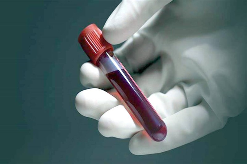 ما رأي الطب الحديث بـ"حميّة فصيلة الدم"؟