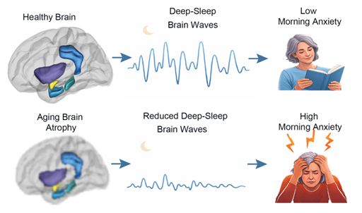 Diagram showing how healthy brains with deep-sleep waves reduce morning anxiety compared to aging brains with sleep issues. A new study shows how brain aging impairs the generation of slow wave activity during sleep, leading to elevated anxiety the next day – Graphic courtesy of Dr. Eti Ben Simon