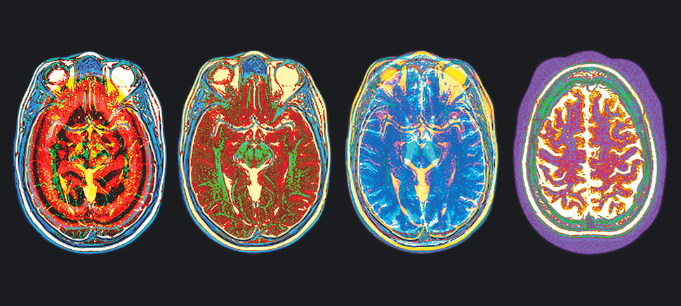 Multiple colored brain scans in wallpaper format