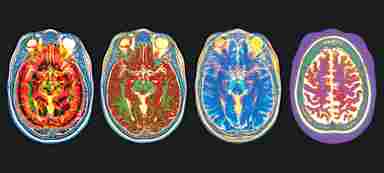 Multiple colored brain scans in wallpaper format