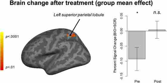 Figure 2. The group-level brain activation change before and after virtual reality-social cognition training. 