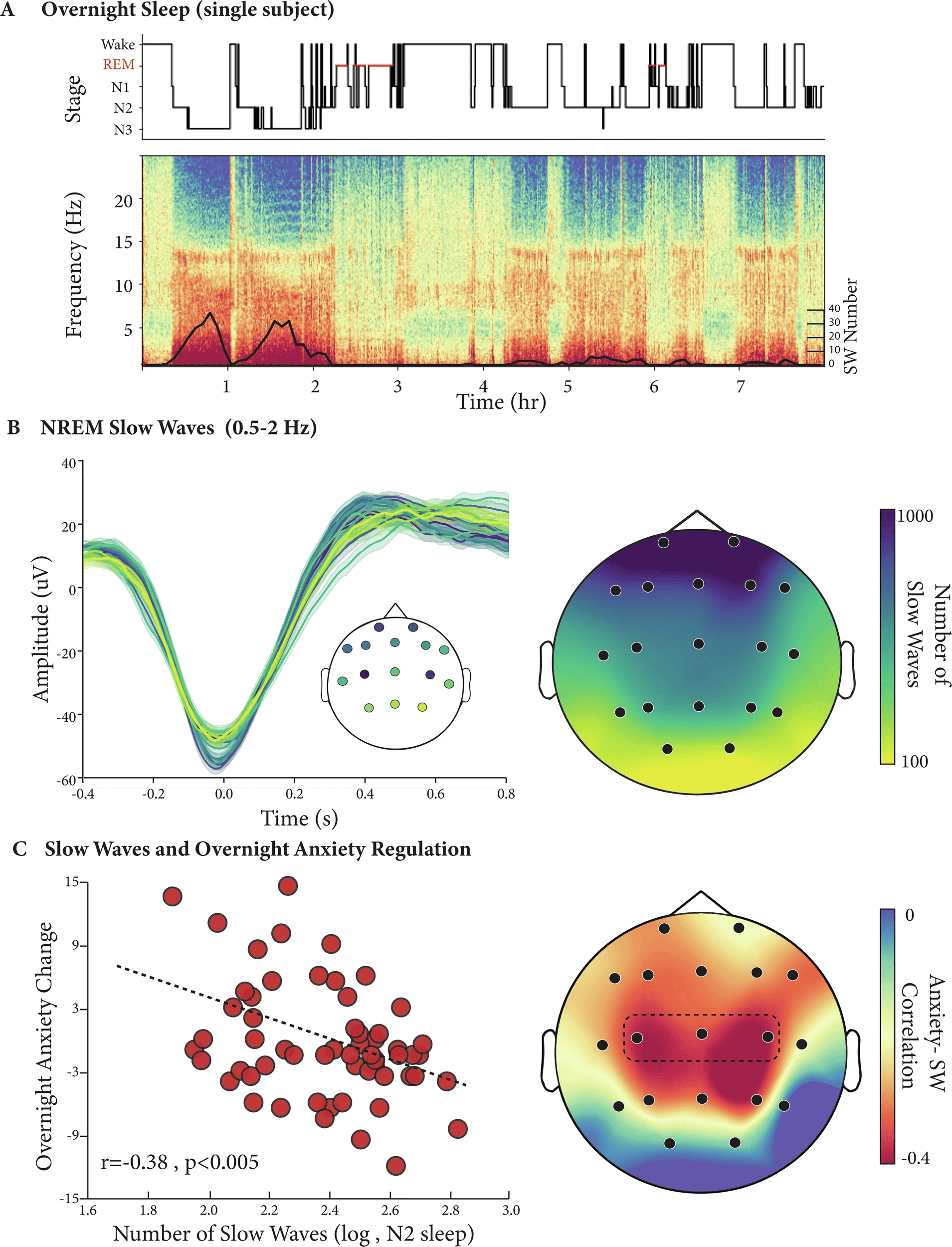 A Hypnogram of a single subject (top) with its corresponding multitaper spectrogram (Bottom, C3 channel). The superimposed black line denotes the number of detected slow wave events across the night (5 min averages). B Detected slow waves from NREM sleep (left panel, single subject example, minimum 100 detections per plotted channel) and average slow wave counts across participants (N = 61, right panel). C Increased number of slow waves during NREM2 sleep is associated with lower next-day anxiety (N = 58, R = -0.38, P < 0.005, central derivative, left panel) also evident across the scalp (right panel, predefined central derivative marked in a dotted line, only channels with a minimum of 20 detections are plotted).