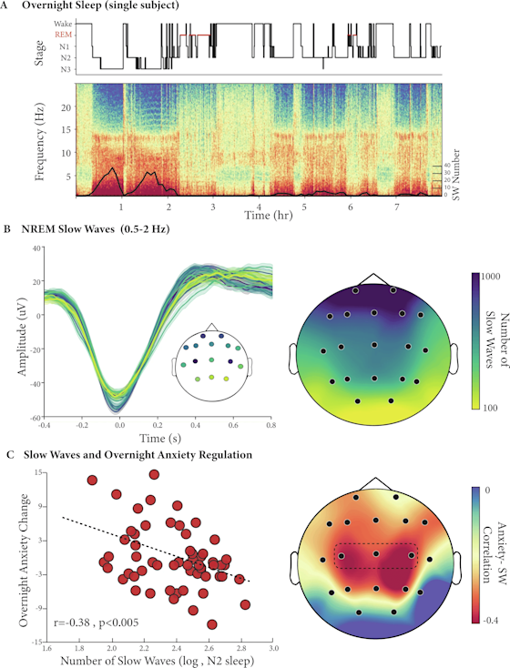 A Hypnogram of a single subject (top) with its corresponding multitaper spectrogram (Bottom, C3 channel). The superimposed black line denotes the number of detected slow wave events across the night (5 min averages). B Detected slow waves from NREM sleep (left panel, single subject example, minimum 100 detections per plotted channel) and average slow wave counts across participants (N = 61, right panel). C Increased number of slow waves during NREM2 sleep is associated with lower next-day anxiety (N = 58, R = -0.38, P < 0.005, central derivative, left panel) also evident across the scalp (right panel, predefined central derivative marked in a dotted line, only channels with a minimum of 20 detections are plotted).