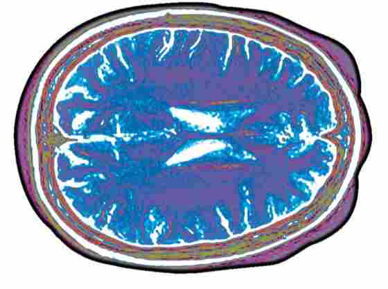 Three Multicolored Brain Scans on white background.