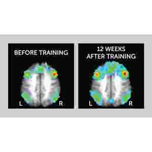 Brain scans showing functional connectivity of regions associated with the Central Executive Network.

Chapman, S. B., et al. “Neural Mechanisms of Brain Plasticity with Complex Cognitive Training in Healthy Seniors.” Cerebral Cortex, vol. 25, no. 2, 2013, pp. 396–405., doi:10.1093/cercor/bht234.12