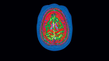 A multicolored scan of a human brain shown from the top-down.