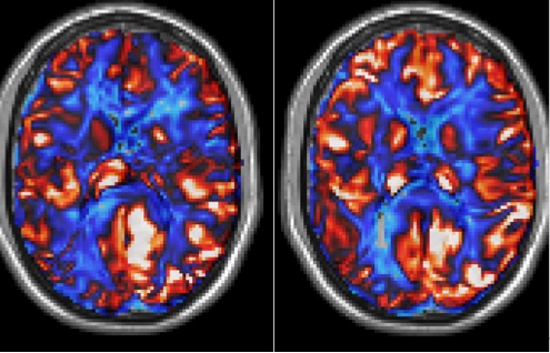 Shows capacity to increase whole brain blood flow after complex mental training. NEED MORE DETAIL FROM STUDY.