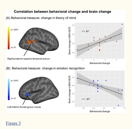 Figure 3 - The portion of the brain highlighted in red, the right posterior superior temporal sulcus (pSTS), is an area associated with the integration of visual, auditory, and somatosensory cues of other’s behaviors. This is an important piece of social interaction, as it allows us to process incoming information and make predictions about what we think someone will do next. Decreased activation in the portion of the brain highlighted in blue, the left inferior frontal gyrus, was shown to be associated with gains in participants’ socio-emotional processing of identifying emotions.